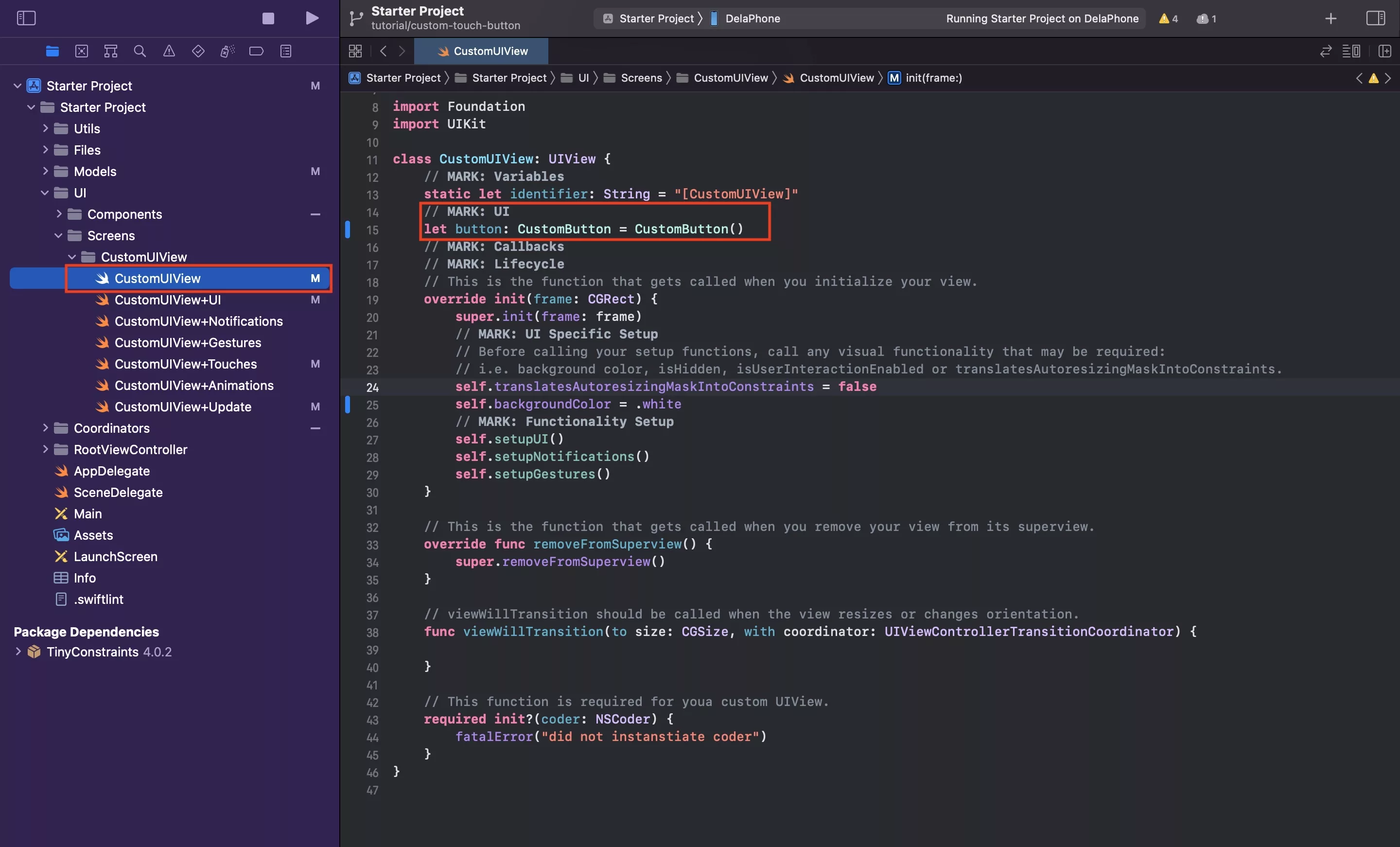 A screenshot of Xcode of the CustomUIView UIView with the declaration of the custom button constant.